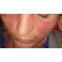 GEL FACIAL Y CORPORAL CALMANTE CUTANEO DE ALOEVERA 100 ML