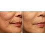 7 CAPSULAS SUERO FACIAL CON ÁCIDO HIALURONICO HIDRATANTE