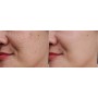 SERUM FACIAL ACLARANTE LIMON QUITA MANCHAS