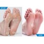 EXFOLIANTE PARA LOS PIES TRATAMIENTO DE PIEL